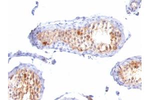 Formalin-fixed, paraffin-embedded human Testis stained with MART-1 / Melan-A Monoclonal Antibody (A103+M2-7C10+M2-9E3). (MLANA 抗体)