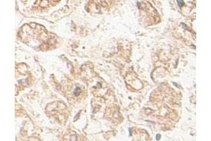 Immunohistochemical staining of formalin-fixed paraffin-embedded human fetal liver tissue showing membrane staining with AGPS polyclonal antibody  at 1 : 100 dilution. (AGPS 抗体  (AA 462-632))