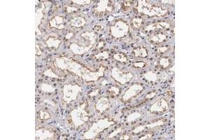 Immunohistochemical staining (Formalin-fixed paraffin-embedded sections) of human kidney with NR4A2 polyclonal antibody  shows moderate membranous and nuclear positivity in cells in tubules. (NR4A2 抗体)