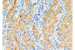 ABIN6258028 and ABIN6274976 at 1/100 staining Rat kidney tissue by IHC-P. (COMT 抗体  (N-Term))