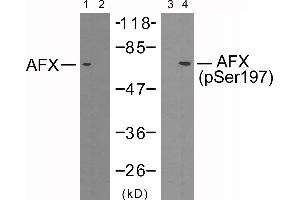Western blot analysis of extracts from 293 cells using AFX (Ab-197) antibody (Line 1 and 2) and AFX (phospho-Ser197) antibody (Line 3 and 4). (FOXO4 抗体  (pSer197))