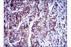 Immunohistochemistry (IHC) image for anti-Doublecortin (DCX) (AA 362-411) antibody (ABIN1844030)