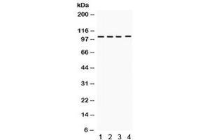 Western blot testing of 1) rat spleen, 2) rat thymus, 3) human placenta and 4) HeLa lysate with HDAC7 antibody.