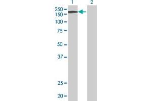 Western Blot analysis of A2M expression in transfected 293T cell line by A2M MaxPab polyclonal antibody. (alpha 2 Macroglobulin 抗体  (AA 1-1474))