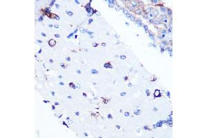 Immunohistochemistry (IHC) image for anti-Y Box Binding Protein 1 (YBX1) antibody (ABIN7271410)