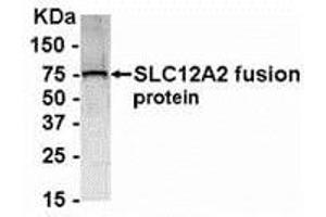 Western Blotting (WB) image for anti-Solute Carrier Family 12 (Potassium-Chloride Transporter) Member 2 (SLC12A2) (AA 800-1000) antibody (ABIN2468175) (SLC12A2 抗体  (AA 800-1000))