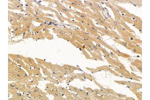 ABIN6256960 and ABIN6274918 at 1/100 staining rat heart tissue by IHC-P. (BMP10 抗体  (Internal Region))