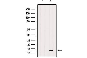 Western blot analysis of extracts from Hela, using PPP1R1C Antibody.