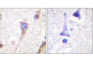 Immunohistochemistry analysis of paraffin-embedded human brain tissue, using PKD1/PKC mu (Ab-463) Antibody. (PKC mu 抗体  (AA 429-478))