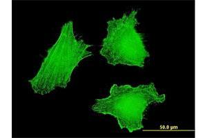 Immunofluorescence of monoclonal antibody to DLX5 on HeLa cell. (DLX5 抗体  (AA 1-110))