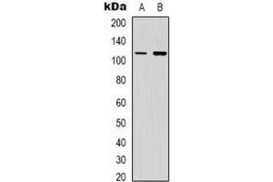 Western blot analysis of PI3K p110 gamma expression in Jurkat (A), NIH3T3 (B) whole cell lysates.