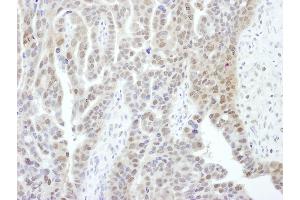anti-Proteasome (Prosome, Macropain) 26S Subunit, Non-ATPase, 1 (PSMD1) (AA 1-50) antibody