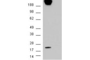 Image no. 3 for anti-Caveolin 1, Caveolae Protein, 22kDa (CAV1) (Internal Region) antibody (ABIN374578) (Caveolin-1 抗体  (Internal Region))