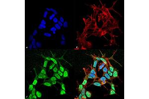 Immunocytochemistry (ICC) image for anti-Sodium Channel, Voltage-Gated, Type III, beta Subunit (SCN3B) (AA 1-215) antibody (Atto 488) (ABIN6932446)