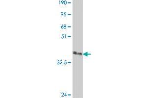 Western Blot detection against Immunogen (37. (DIRAS2 抗体  (AA 81-180))