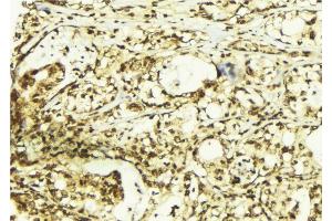 Immunohistochemistry (IHC) image for anti-Protein Kinase C (pan) (PKC pan) (pThr497) antibody (ABIN6256576)