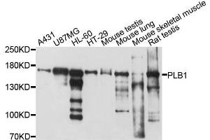 Western blot analysis of extracts of various cell lines, using PLB1 antibody. (Phospholipase B 抗体  (AA 1110-1415))