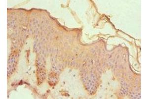 Immunohistochemistry of paraffin-embedded human skin tissue using ABIN7148815 at dilution of 1:100 (CREB3 抗体  (AA 1-230))