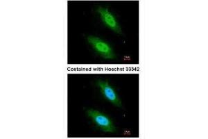ICC/IF Image Immunofluorescence analysis of paraformaldehyde-fixed HeLa, using CARD8, antibody at 1:200 dilution. (CARD8 抗体  (C-Term))