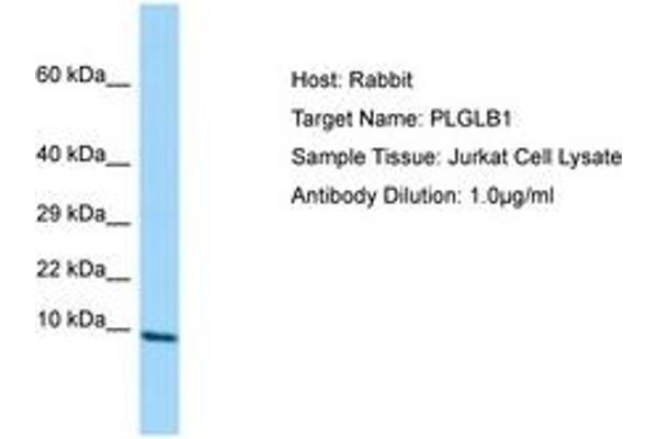 PLGLB2 anticorps  (AA 38-87)