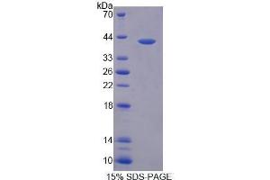SDS-PAGE (SDS) image for Prokineticin 2 (PROK2) (AA 30-128) protein (His tag,GST tag) (ABIN3209866) (PROK2 Protein (AA 30-128) (His tag,GST tag))