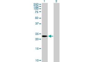 Western Blot analysis of C1orf83 expression in transfected 293T cell line by C1orf83 MaxPab polyclonal antibody. (TCEANC2 抗体  (AA 1-208))