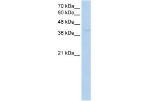 RNF165 antibody used at 1 ug/ml to detect target protein. (RNF165 抗体  (Middle Region))