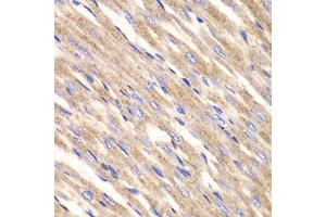 Immunohistochemistry of paraffin-embedded rat heart using SLC25A4 antibody at dilution of 1:100 (400x lens). (SLC25A4 抗体)