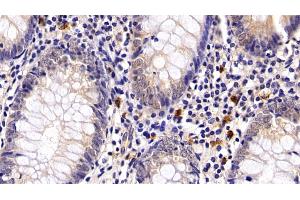 Immunohistochemistry (IHC) image for anti-Programmed Cell Death 1 (PDCD1) (AA 41-132) antibody (ABIN7440431)