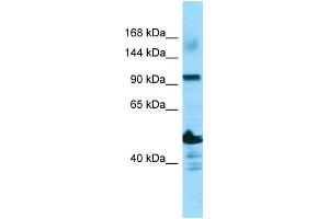 WB Suggested Anti-ADAMTS14 Antibody Titration: 1. (ADAMTS14 抗体  (N-Term))