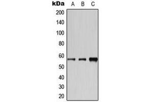 Western Blotting (WB) image for anti-Cytochrome P450, Family 2, Subfamily A, Polypeptide 6 (CYP2A6) (N-Term) antibody (ABIN7299210)