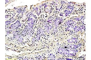 Formalin-fixed and paraffin embedded rat colitis tissue labeled with Rabbit Anti-Podoplanin/gp36 Polyclonal Antibody (ABIN736896), Unconjugated 1:200 followed by conjugation to the secondary antibody and DAB staining