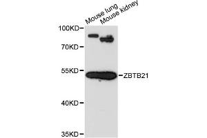 Western blot analysis of extracts of various cell lines, using ZBTB21 antibody (ABIN6291079) at 1:3000 dilution. (ZNF295 抗体)