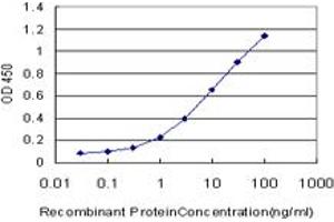 Detection limit for recombinant GST tagged EPM2AIP1 is approximately 0. (EPM2AIP1 抗体  (AA 508-606))