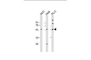 All lanes : Anti-CCT8L2 Antibody (C-Term) at 1:2000 dilution Lane 1: A431 whole cell lysate Lane 2: Hela whole cell lysate Lane 3: PC-3 whole cell lysate Lysates/proteins at 20 μg per lane. (CCT8L2 抗体  (AA 511-542))