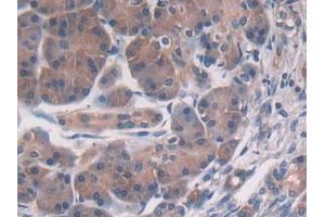 DAB staining on IHC-P; Samples: Human Pancreas Tissue (PSMD2 抗体  (AA 645-872))