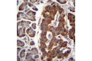 Formalin fixed and paraffin embedded human pancreas tissue reacted with Dermatopontin Antibody (N-term) followed by peroxidase conjugation of the secondary antibody and DAB staining. (Dermatopontin 抗体  (N-Term))