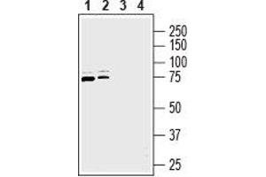 Western Blotting (WB) image for anti-Solute Carrier Family 9 (Sodium/hydrogen Exchanger), Member 6 (SLC9A6) (AA 515-528), (Intracellular) antibody (ABIN7043760)