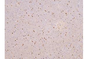 IHC analysis of RBMS3 using anti-RBMS3 antibody (ABIN6719584).