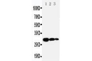 Anti-TIMP1 antibody, Western blotting Lane 1: Recombinant Human TIMP-1 Protein 10ng Lane 2: Recombinant Human TIMP-1 Protein 5ng Lane 3: Recombinant Human TIMP-1 Protein 2. (TIMP1 抗体  (C-Term))
