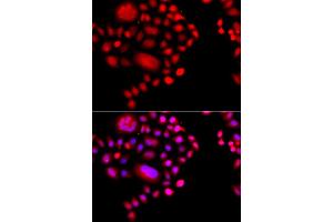Immunofluorescence analysis of A549 cell using POLR1D antibody. (POLR1D 抗体)