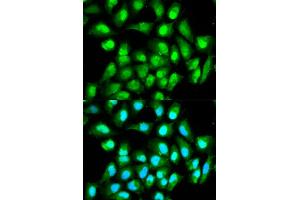 Immunofluorescence analysis of HeLa cell using RAN antibody. (RAN 抗体)