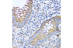 Immunohistochemistry of paraffin-embedded human appendix using  antibody (ABIN7265428) at dilution of 1:100 (40x lens). (ACOT2 抗体  (AA 222-483))
