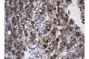 Image no. 3 for anti-TSC22 Domain Family, Member 1 (TSC22D1) antibody (ABIN1501537)