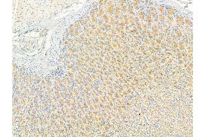 ABIN6256757 and ABIN6267314 at 1/100 staining Rat stomach tissue by IHC-P.