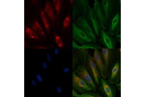 ABIN6259993 and ABIN6278082 staining  cells by IF/ICC. (Apolipoprotein D 抗体  (Internal Region))