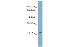WB Suggested Anti-CCDC25 Antibody Titration: 0. (CCDC25 抗体  (Middle Region))