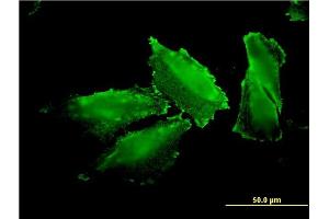Immunofluorescence of monoclonal antibody to MARS on HepG2 cell. (Mars (MARS) (AA 801-899) 抗体)