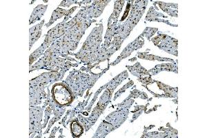 IHC analysis of H Cadherin/CDH13 using anti-H Cadherin/CDH13 antibody (ABIN7600095). (Cadherin 13 抗体  (AA 149-692))