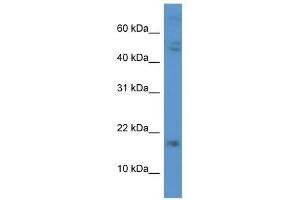 Western Blot showing CGB antibody used at a concentration of 1. (CGB 抗体  (C-Term))